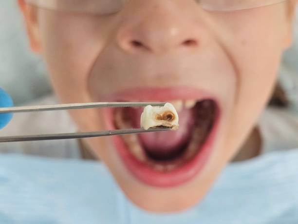 Best Mobile Emergency Dentist in Brookdale, CA