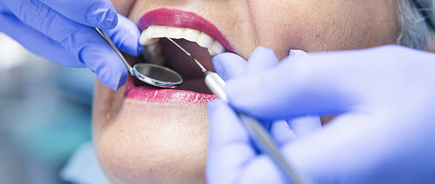 Best Emergency Dentist for Knocked-Out Tooth in Brookdale, CA